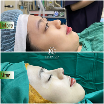 Slider image (7) Dr. Ho Co - Aesthetics and Plastic Surgery in Vietnam